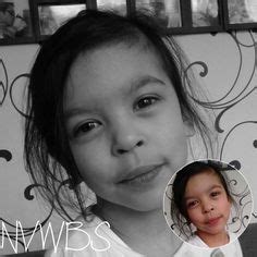 Am j med genet c semin med genet. 15 Best Williams Syndrome images | Williams syndrome ...