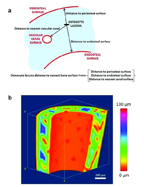 It is a bone is one of two kinds of bone tissue that can be found in the body of a only tiny spaces (lacunae) are left which that contain the bone cells or osteocytes. Distance of osteocyte lacunae to nearest bone surface. (a ...