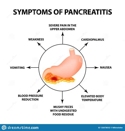 We did not find results for: Symptoms Of Pancreatitis. The Structure Of The Stomach And ...