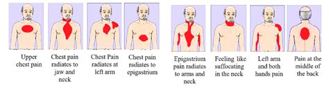 Indicators And Symptoms Of Chest Pain At The Heart Attack Download