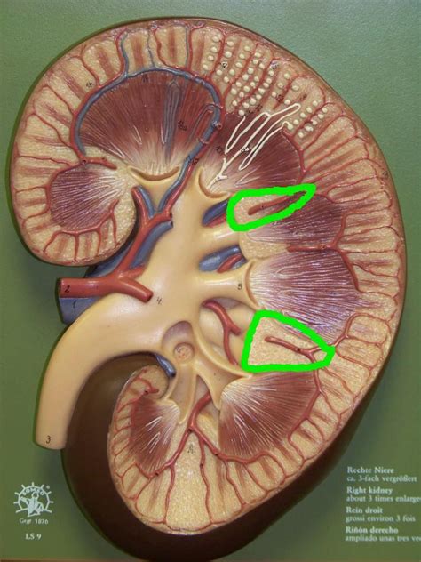 Lesions that characterize renal papillary necrosis come from an impairment of the blood supply and from subsequent ischemic necrosis that is diffuse. Lab Practical 3 - Biology 211 with Weber at Central ...