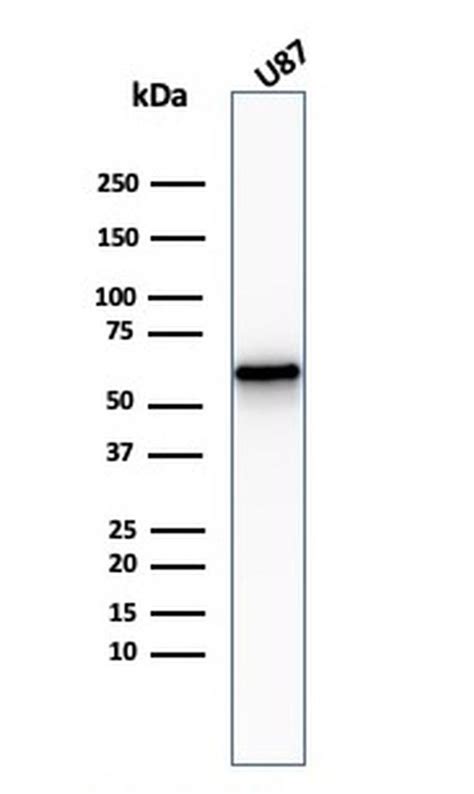 Ngf Receptor P75cd271 Recombinant Monoclonal Antibody Ngfr 2550r