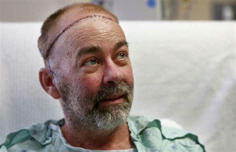 Houstons Skull Scalp Transplant Is Just One Of Citys Medical Firsts