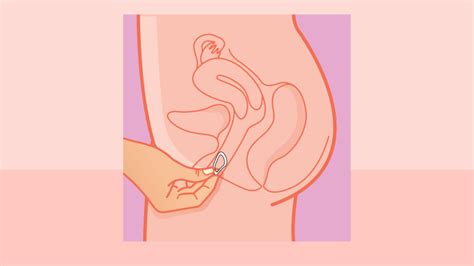 Annovera Vs Nuvaring Is A Vaginal Ring The Right Birth Control For You Reviewed