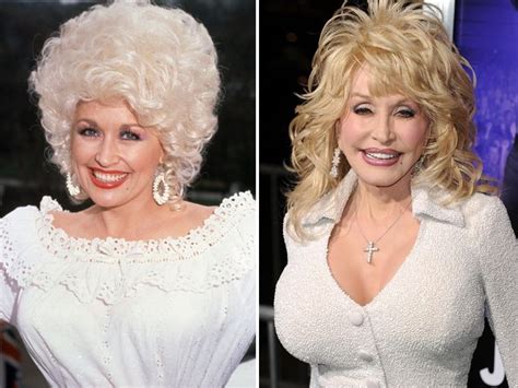 26 Over The Top Hollywood Plastic Surgeries V103 Dolly Parton