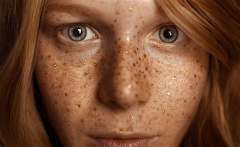 Golden Freckles By Ciro Galluccio On 500px Photography Day Nature Photography Freckles