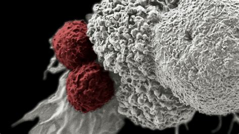 Sex Hormones Limit Cancer Immunotherapy Success Cancer Translated
