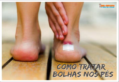 Bolha Inflamada No Pé