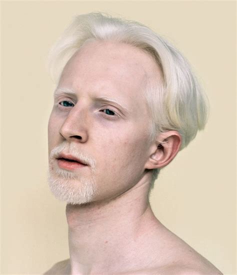 Mini Title — Personal Ericnehr Albino Men Albino Human Albino Model
