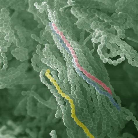 ⇒ all fungi are eukaryotic protists. Molds are able to reproduce sexually, unlike we thought ...