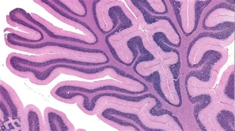 Histology The Cerebellum Youtube