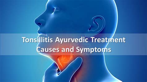 Tonsillitis Ayurveda Treatment Causes And Symptoms By Ath Ayurdhamah
