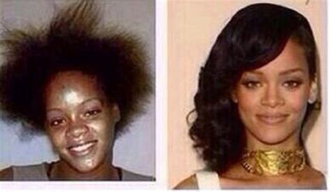 rihanna before and after celebrity plastic surgery rhinoplasty before and after celebrities