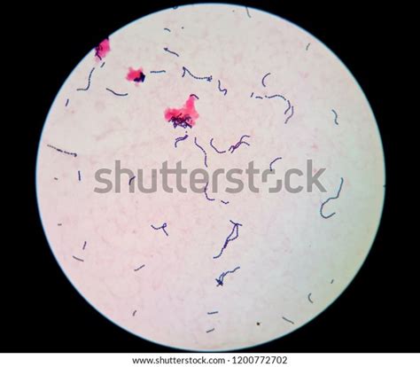 Gram Positive Cocci Chains Streptococcus Species Stock Photo Edit Now