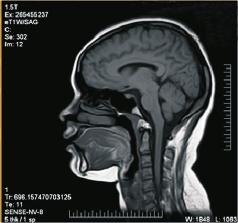 Shows The Sagittal Section Of The Control Case Normal Anatomy Of The