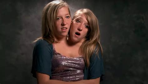 Conjoined Twins Abby And Brittanys Exciting News Trendy Matter