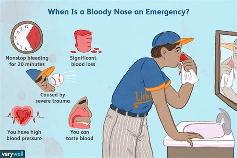 Medical School Nose Bleedepistaxis How To Manage Nose Bleeds