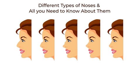 13 Types Of Noses And All You Need To Know About Them Nose Nose Types Nose Shapes