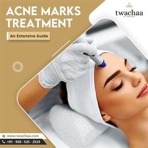 Your Extensive Guide to the Best Acne Marks Treatment