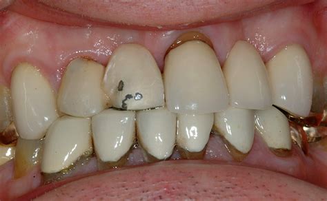 Our range of Dental Treatments - Restore32 Dental Practice, York