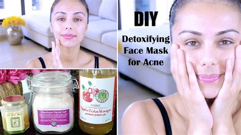 Diy Detoxifying Face Mask ♥ For Acne Skin Discoloration Scars