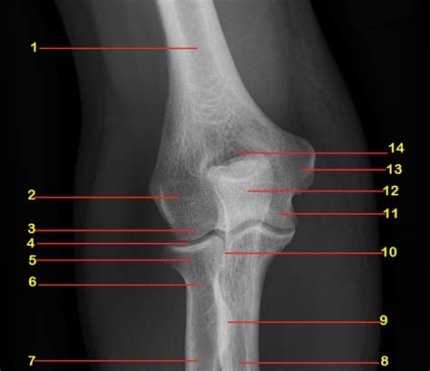 Radiology Normal Elbow X Ray Diagram Quizlet