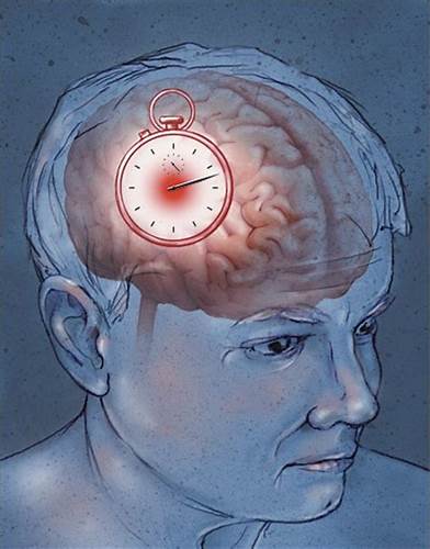 Диета при инсульте и после инсульта - меню, отзывы Картинка - Диета при инсульте и после инсульта - меню, отзывы