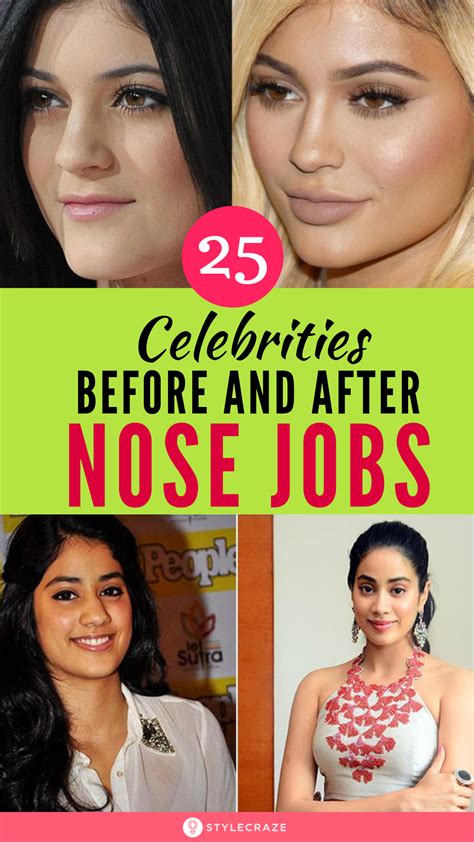 Top 25 Celebrities Before And After Plastic Surgery And Nose Jobs We