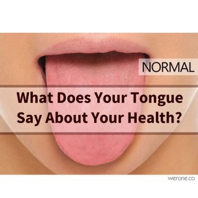 What Does Your Tongue Say About Your Health Werone