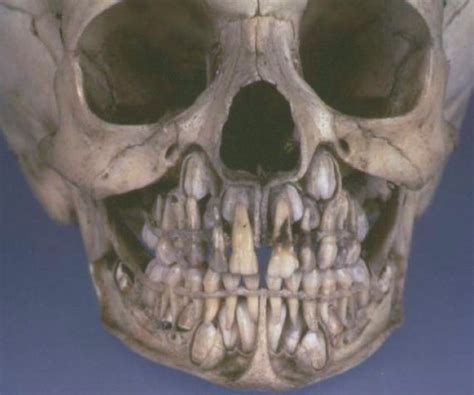 This Is What Your Skull Looks Like Before Losing Baby Teeth...It Is