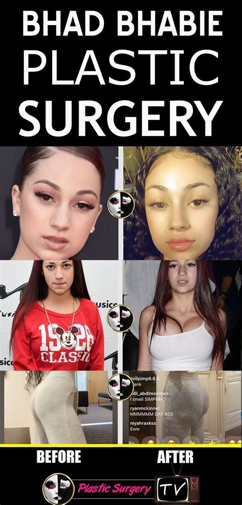 Bhad Bhabie Cash Me Outside Nose Job Rhinoplasty Boob Job Breast Implants Butt Shots Butt