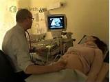 Eclampsia Mayo Clinic Pictures