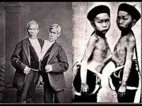 The two were born in 1811 in siam (thailand) with fused torso, and they soon became a sideshow act p.t. The most famous conjoined twins in the world history ...