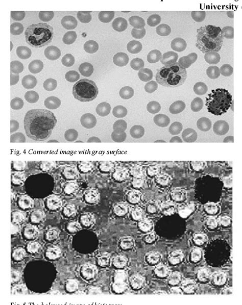 Figure 4 From Design A New Algorithm To Count White Blood Cells For