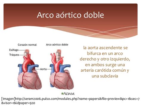 Arteria Aorta — Wikisabio