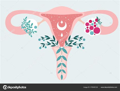 Pcos Anatomical Scheme Of Uterus In Flowers Polycystic Ovary