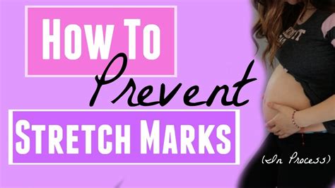 how to prevent stretch marks youtube