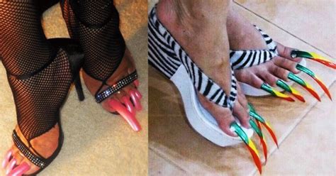 Una uña del pie negra no siempre está causada por el running, y no siempre es inofensiva. Uñas de los pies horribles | Historias increibles