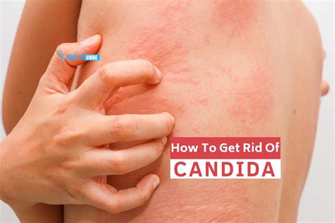 Forget waxing, here are 5 natural ways to get rid of unwanted hair. 5 Amazing Natural Ways For How To Get Rid Of Candida | How ...