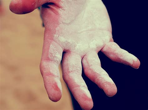 Jul 21, 2019 · one of the easiest ways to prevent calluses is by investing in a good pair of weightlifting gloves. Is there something I can wrap around my knuckles to stop ...