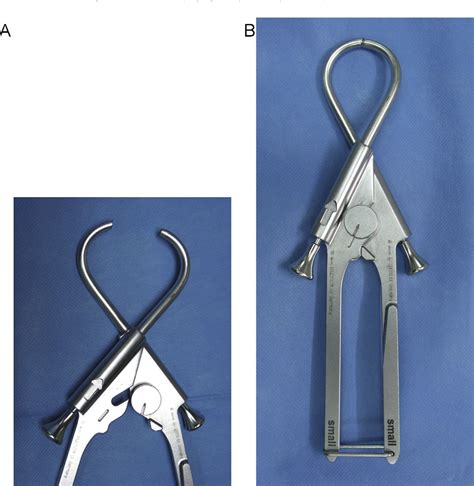 Figure 1 From Percutaneous Cerclage Wiring Does It Disrupt Femoral