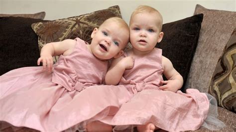 Miracle Twin Babies Land Casualty Acting Roles After Being Given Just 5