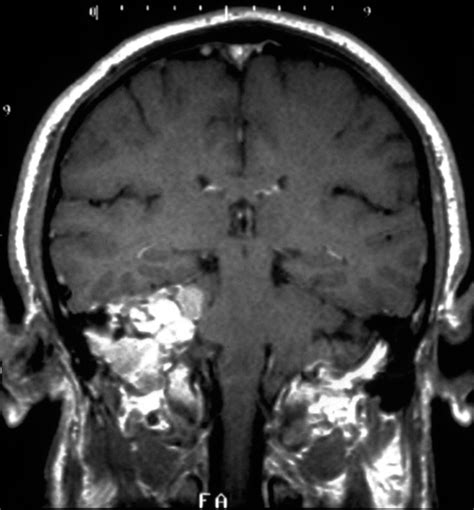 Pathology Quiz Case 1 Congenital Defects Jama Otolaryngologyhead And Neck Surgery Jama Network