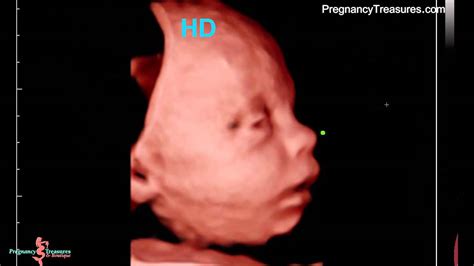 3d 4d Ultrasound And Hd Ultrasounds 29 Weeks Scan Of The Week Youtube