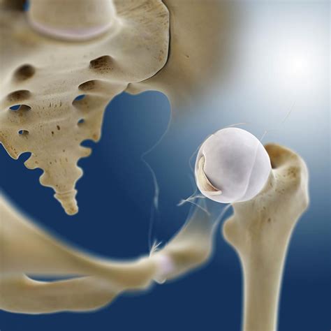 Hip Anatomy Photograph By Springer Medizinscience Photo Library