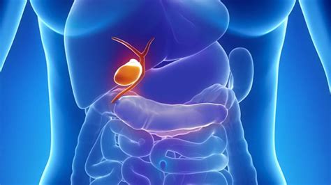 When you eat, your gallbladder contracts and empties bile into your small intestine (duodenum). Gallbladder Cancer Homeopathy Treatment In Mumbai, Delhi ...