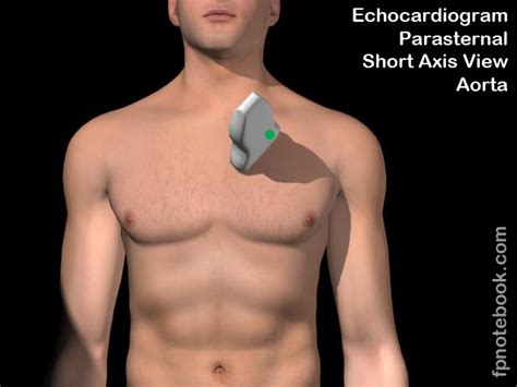 Shorting is a great strategy to use in bear markets or during reversal setups. Parasternal Short-Axis Echocardiogram View