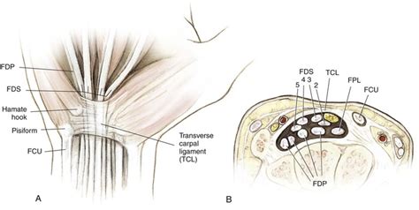 There are only a few fine stitches holding the repair together and these can easily be pulled apart. Fdp Fds Tendons - Tendons Of Fdp Dupuytren S Contracture ...