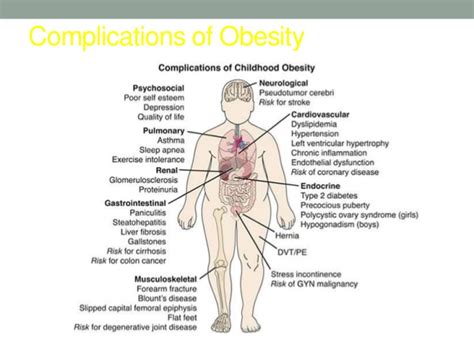 Some comorbidities occur purely by chance. Obesity dr njeru