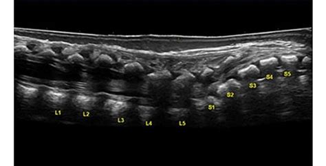 Vascular Ultrasound Medical Ultrasound Diagnostic Medical Sonography
